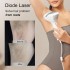 DermRays V8S Diode Laser Hair Removal